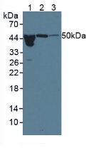 ORM1 / Orosomucoid Antibody - Western Blot; Sample: Lane1: Human Serum; Lane2: Rat Pancreas Tissue; Lane3: Rat Bladder Tissue.
