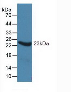 ORM1 / Orosomucoid Antibody - WesternBlot;Sample:Recombinanta1AGP,Human.