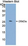 ORM2 / Orosomucoid 2 Antibody - Western blot of recombinant ORM2 / Orosomucoid 2.  This image was taken for the unconjugated form of this product. Other forms have not been tested.