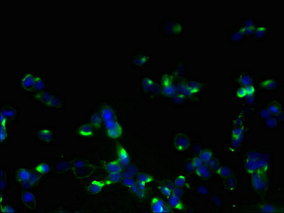 ORMDL1 Antibody - Immunofluorescent analysis of 293T cells using ORMDL1 Antibody at dilution of 1:100 and Alexa Fluor 488-congugated AffiniPure Goat Anti-Rabbit IgG(H+L)