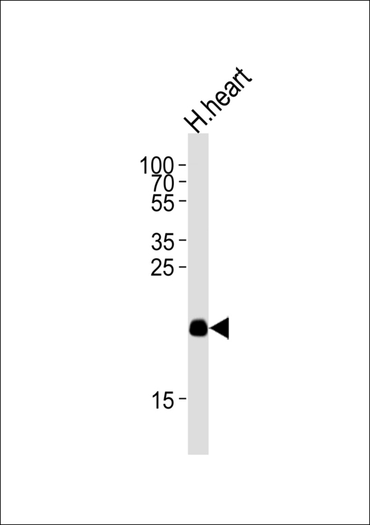 ORMDL2 Antibody - Western blot of lysate from human heart tissue lysate, using ORML2 Antibody. Antibody was diluted at 1:1000 at each lane. A goat anti-rabbit IgG H&L (HRP) at 1:5000 dilution was used as the secondary antibody. Lysate at 35ug per lane.