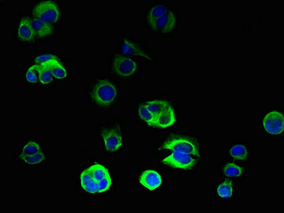 ORMDL2 Antibody - Immunofluorescent analysis of MCF-7 cells using ORMDL2 Antibody at dilution of 1:100 and Alexa Fluor 488-congugated AffiniPure Goat Anti-Rabbit IgG(H+L)