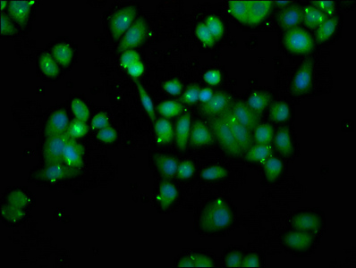 ORMDL3 Antibody - Immunofluorescence staining of PC3 cells at a dilution of 1:166, counter-stained with DAPI. The cells were fixed in 4% formaldehyde, permeabilized using 0.2% Triton X-100 and blocked in 10% normal Goat Serum. The cells were then incubated with the antibody overnight at 4 °C.The secondary antibody was Alexa Fluor 488-congugated AffiniPure Goat Anti-Rabbit IgG (H+L) .
