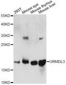 ORMDL3 Antibody - Western blot analysis of extracts of various cell lines, using ORMDL3 antibody at 1:1000 dilution. The secondary antibody used was an HRP Goat Anti-Rabbit IgG (H+L) at 1:10000 dilution. Lysates were loaded 25ug per lane and 3% nonfat dry milk in TBST was used for blocking. An ECL Kit was used for detection and the exposure time was 60s.