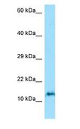 ORMDL3 Antibody - ORMDL3 antibody Western Blot of Jurkat.  This image was taken for the unconjugated form of this product. Other forms have not been tested.