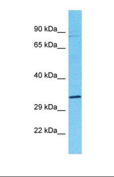 OS9 Antibody - Western blot of Human Lung Tumor. OS9 antibody dilution 1.0 ug/ml.  This image was taken for the unconjugated form of this product. Other forms have not been tested.