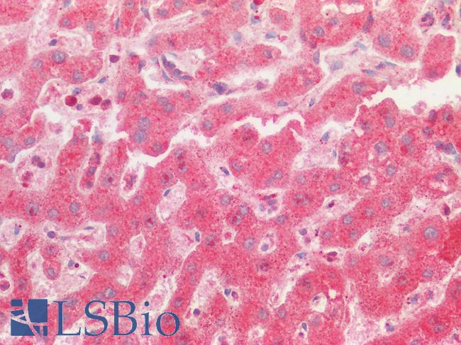 OS9 Antibody - Human Liver, Hepatic Cells: Formalin-Fixed, Paraffin-Embedded (FFPE)