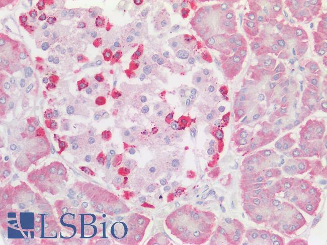 OS9 Antibody - Human Pancreas, Islets of Langerhans: Formalin-Fixed, Paraffin-Embedded (FFPE)
