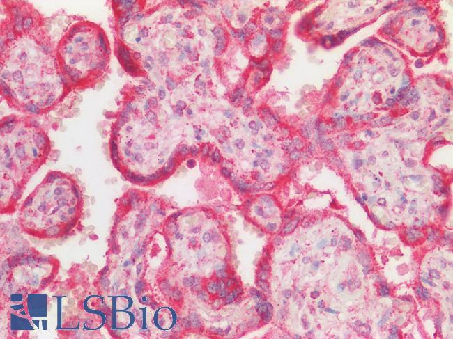 OS9 Antibody - Human Placenta, Trophoblasts: Formalin-Fixed, Paraffin-Embedded (FFPE)