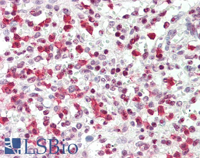 OS9 Antibody - Anti-OS9 antibody IHC staining of human spleen. Immunohistochemistry of formalin-fixed, paraffin-embedded tissue after heat-induced antigen retrieval. Antibody concentration 5 ug/ml.  This image was taken for the unconjugated form of this product. Other forms have not been tested.