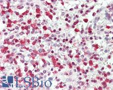 OS9 Antibody - Anti-OS9 antibody IHC staining of human spleen. Immunohistochemistry of formalin-fixed, paraffin-embedded tissue after heat-induced antigen retrieval. Antibody concentration 5 ug/ml.  This image was taken for the unconjugated form of this product. Other forms have not been tested.