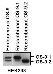OS9 Antibody - Detection of OS-9.1 and OS-9.2 in total HEK293 cells, HEK293 cells expressing OS-9.1 or OS-9.2 by western analysis.  This image was taken for the unconjugated form of this product. Other forms have not been tested.