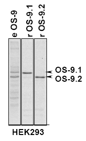 OS9 Antibody - Immunoprecipitation of OS-9.1 and OS-9.2 in total HEK293 cells, HEK293 cells expressing OS-9.1 or OS-9.2.  This image was taken for the unconjugated form of this product. Other forms have not been tested.