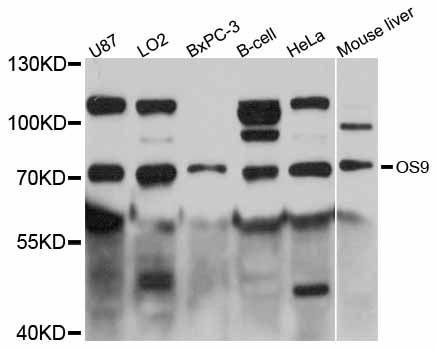 OS9 Antibody - Western blot analysis of extracts of various cell lines, using OS9 antibody at 1:3000 dilution. The secondary antibody used was an HRP Goat Anti-Rabbit IgG (H+L) at 1:10000 dilution. Lysates were loaded 25ug per lane and 3% nonfat dry milk in TBST was used for blocking. An ECL Kit was used for detection and the exposure time was 15s.