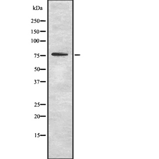 OS9 Antibody - Western blot analysis OS9 using RAW264.7 whole cells lysates