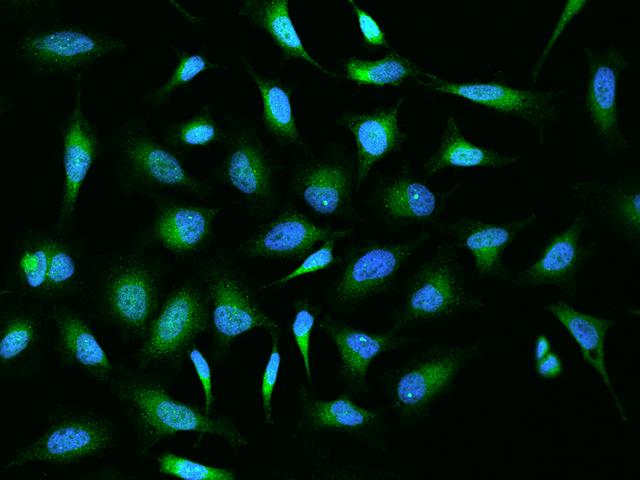 OS9 Antibody - Immunofluorescence staining of OS9 in HeLa cells. Cells were fixed with 4% PFA, permeabilzed with 0.1% Triton X-100 in PBS, blocked with 10% serum, and incubated with rabbit anti-Human OS9 polyclonal antibody (dilution ratio 1:200) at 4°C overnight. Then cells were stained with the Alexa Fluor 488-conjugated Goat Anti-rabbit IgG secondary antibody (green) and counterstained with DAPI (blue). Positive staining was localized to Cytoplasm.