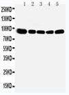 OSBP Antibody - WB of OSBP antibody. Lane 1: Rat Kidney Tissue Lysate. Lane 2: Rat Spleen Tissue Lysate. Lane 3: Rat Lung Tissue Lysate. Lane 4: HELA Cell Lysate. Lane 5: A549 Cell Lysate.