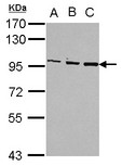 OSBP Antibody - Sample (30 ug of whole cell lysate) A: Jurkat B: Raji C: K562 7.5% SDS PAGE OSBP antibody diluted at 1:1000