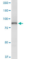 OSBP Antibody - OSBP monoclonal antibody (M01), clone 5A3. Western Blot analysis of OSBP expression in Jurkat.