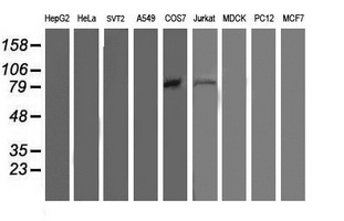 OSBP Antibody - Western blot of extracts (35ug) from 9 different cell lines by using anti-OSBP monoclonal antibody.