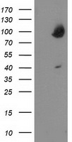 OSBP Antibody - HEK293T cells were transfected with the pCMV6-ENTRY control (Left lane) or pCMV6-ENTRY OSBP (Right lane) cDNA for 48 hrs and lysed. Equivalent amounts of cell lysates (5 ug per lane) were separated by SDS-PAGE and immunoblotted with anti-OSBP.