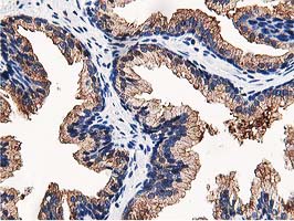 OSBP Antibody - IHC of paraffin-embedded Human prostate tissue using anti-OSBP mouse monoclonal antibody. (Heat-induced epitope retrieval by 10mM citric buffer, pH6.0, 100C for 10min).
