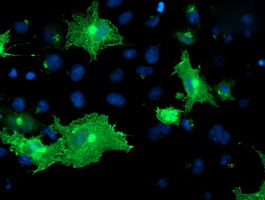 OSBP Antibody - Anti-OSBP mouse monoclonal antibody immunofluorescent staining of COS7 cells transiently transfected by pCMV6-ENTRY OSBP.