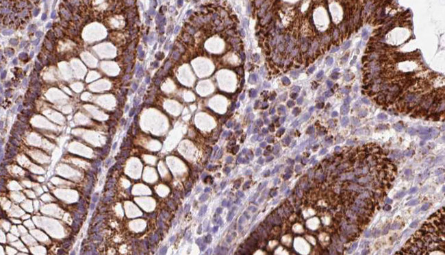 OSBP Antibody - 1:100 staining mouse colon tissue by IHC-P. The sample was formaldehyde fixed and a heat mediated antigen retrieval step in citrate buffer was performed. The sample was then blocked and incubated with the antibody for 1.5 hours at 22°C. An HRP conjugated goat anti-rabbit antibody was used as the secondary.