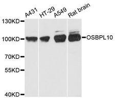 OSBPL10 Antibody - Western blot analysis of extracts of various cell lines, using OSBPL10 antibody at 1:3000 dilution. The secondary antibody used was an HRP Goat Anti-Rabbit IgG (H+L) at 1:10000 dilution. Lysates were loaded 25ug per lane and 3% nonfat dry milk in TBST was used for blocking. An ECL Kit was used for detection and the exposure time was 90s.