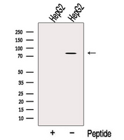 OSBPL10 Antibody - Western blot analysis of extracts of HepG2 cells using OSBPL10 antibody. The lane on the left was treated with blocking peptide.