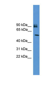 OSBPL11 Antibody - OSBPL11 antibody Western blot of MCF7 cell lysate. This image was taken for the unconjugated form of this product. Other forms have not been tested.
