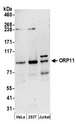 OSBPL11 Antibody - Detection of human ORP11 by western blot. Samples: Whole cell lysate (50 µg) from HeLa, HEK293T, and Jurkat cells prepared using NETN lysis buffer. Antibodies: Affinity purified rabbit anti-ORP11 antibody used for WB at 0.1 µg/ml. Detection: Chemiluminescence with an exposure time of 3 minutes.