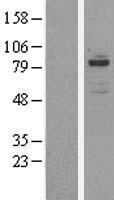 OSBPL11 Protein - Western validation with an anti-DDK antibody * L: Control HEK293 lysate R: Over-expression lysate