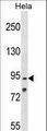 OSBPL1A / ORP1 Antibody - OSBPL1A Antibody western blot of HeLa cell line lysates (35 ug/lane). The OSBPL1A antibody detected the OSBPL1A protein (arrow).