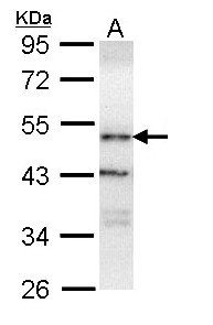 OSBPL1A / ORP1 Antibody - Sample (30 ug of whole cell lysate). A: H1299. 10% SDS PAGE. OSBPL1A / ORP1 antibody diluted at 1:1000.