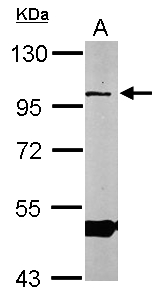 OSBPL1A / ORP1 Antibody - Sample (50 ug of whole cell lysate). A: Mouse brain. 7.5% SDS PAGE. OSBPL1A / ORP1 antibody diluted at 1:1000.