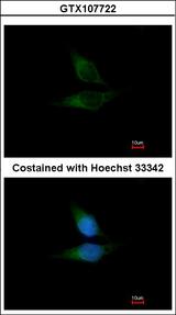 OSBPL1A / ORP1 Antibody - Immunofluorescence of methanol-fixed HeLa using ORP1 antibody at 1:200 dilution.