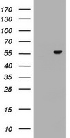 OSBPL2 Antibody - HEK293T cells were transfected with the pCMV6-ENTRY control (Left lane) or pCMV6-ENTRY OSBPL2 (Right lane) cDNA for 48 hrs and lysed. Equivalent amounts of cell lysates (5 ug per lane) were separated by SDS-PAGE and immunoblotted with anti-OSBPL2.