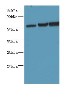 OSBPL2 Antibody - Western blot. All lanes: OSBPL2 antibody at 1 ug/ml. Lane 1: HepG-2 whole cell lysate. Lane 2: Mouse heart tissue. Lane 3: HeLa whole cell lysate. Secondary antibody: Goat polyclonal to Rabbit IgG at 1:10000 dilution. Predicted band size: 55 kDa. Observed band size: 55 kDa.