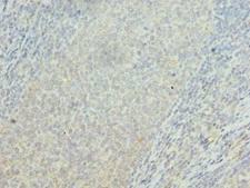 OSBPL2 Antibody - Immunohistochemistry of paraffin-embedded human tonsil tissue using antibody at dilution of 1:100.