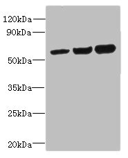 OSBPL2 Antibody - Western blot All lanes: OSBPL2 antibody at 1µg/ml Lane 1: HepG2 whole cell lysate Lane 2: Mouse heart tissue Lane 3: Hela whole cell lysate Secondary Goat polyclonal to rabbit IgG at 1/10000 dilution Predicted band size: 56, 54 kDa Observed band size: 56 kDa