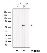 OSBPL2 Antibody - Western blot analysis of extracts of HeLa cells using OSBPL2 antibody. The lane on the left was treated with blocking peptide.