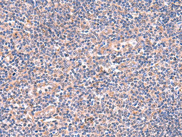 OSBPL2 Antibody - Immunohistochemistry of paraffin-embedded Human tonsil tissue  using OSBPL2 Polyclonal Antibody at dilution of 1:55(×200)