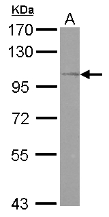 OSBPL5 Antibody - Sample (30 ug of whole cell lysate) A: HeLa 7.5% SDS PAGE OSBPL5 antibody diluted at 1:500