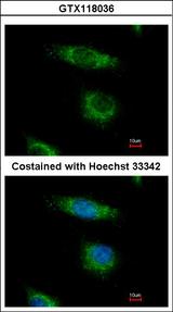 OSBPL5 Antibody - Immunofluorescence of paraformaldehyde-fixed HeLa, using OSBPL5 antibody at 1:500 dilution.