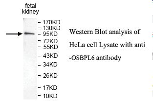 OSBPL6 Antibody