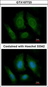 OSBPL6 Antibody - Immunofluorescence of paraformaldehyde-fixed HeLa using OSBPL6 antibody at 1:200 dilution.