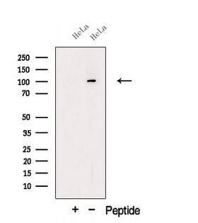 OSBPL6 Antibody - Western blot analysis of extracts of HeLa cells using OSBL6 antibody. The lane on the left was treated with blocking peptide.