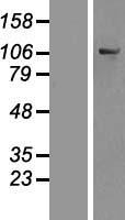 OSBPL6 Protein - Western validation with an anti-DDK antibody * L: Control HEK293 lysate R: Over-expression lysate