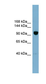 OSBPL8 Antibody - OSBPL8 antibody Western blot of OVCAR-3 cell lysate. This image was taken for the unconjugated form of this product. Other forms have not been tested.